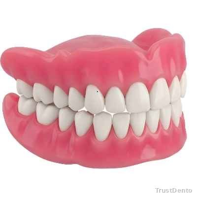 Full Mouth Rehabilitation Cost dental treatment illustration