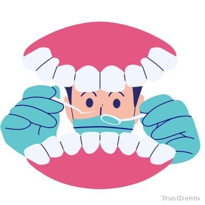 Smile Makeovers Cost dental treatment illustration
